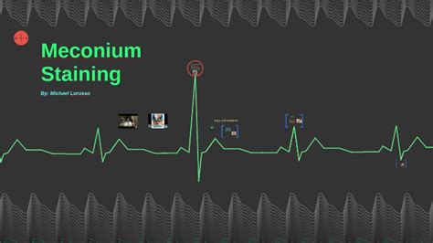 Meconium Staining by Michael Lorusso on Prezi