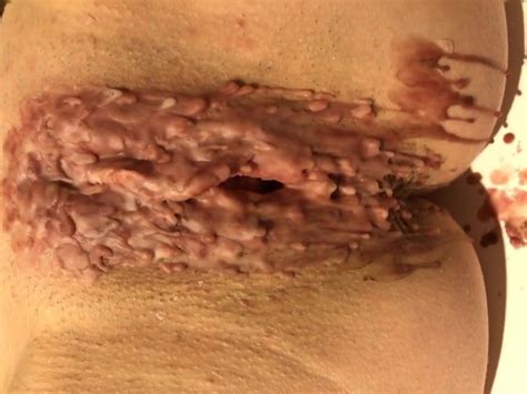 Pussy Filled With Hot Wax Domination Porn Xhamster