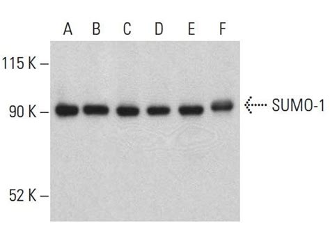 SUMO 1 Antibody D 11 SCBT Santa Cruz Biotechnology