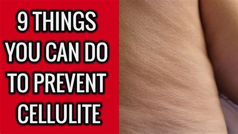 9 Things You Can Do To Prevent Cellulite Youtube