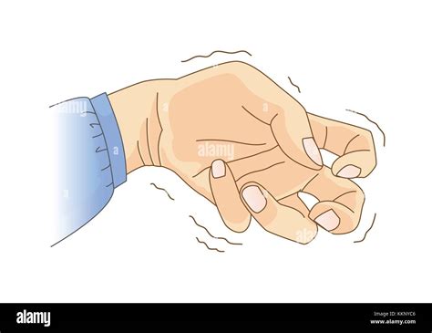 Finger And Wrist Bend And Tremor Symptom Stock Vector Image Art Alamy