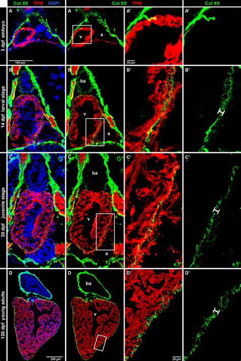 Developmental dynamics of Col XII expression in the zebrafish ... 