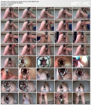 エルマーWORLD XXL anal speculum gaping 227MB mp4 Akiba Online
