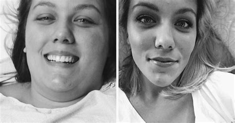 Esta mujer perdió 70 kilos y ahora no se atreve a ponerse bikini Estarguapas