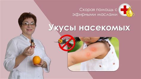 Защита от насекомых Скорая помощь с эфирными маслами - YouTube
