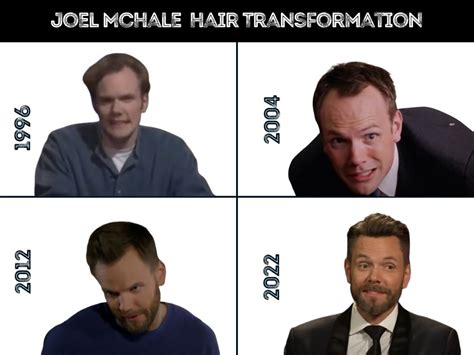 Joel McHale Hair Transplant - Hair Loss & Technical Analysis
