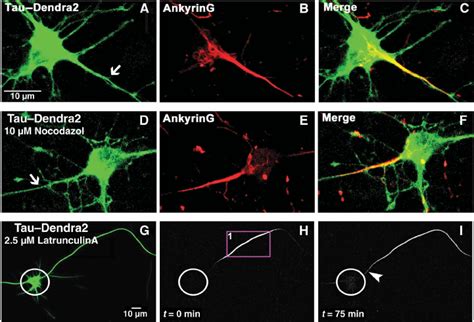 The axonal diffusion barrier for Tau coincides with the axon initial ... 