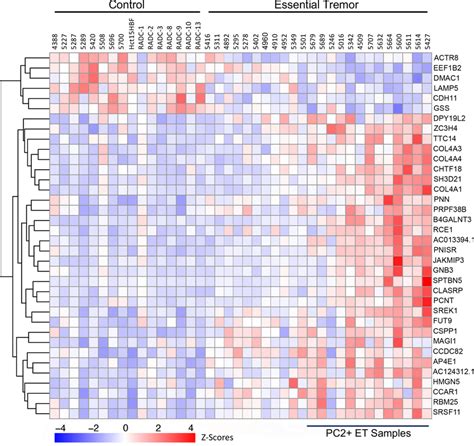 Differential Gene Expression In Et Versus Control Purkinje Cells