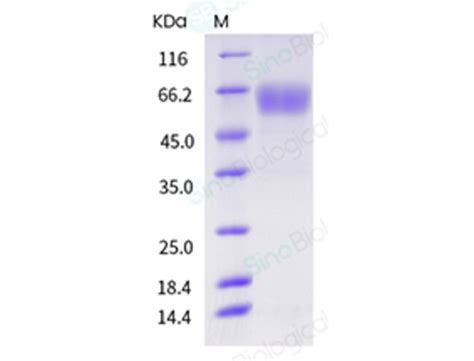 Sino Biological Human CD28 Protein ECD Fc Tag 1 Mg Quantity Each Of