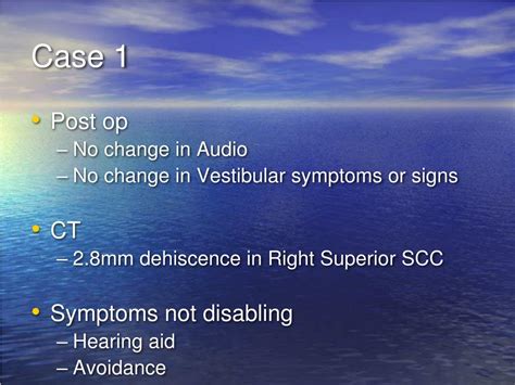 Ppt Superior Semicircular Canal Dehiscence Syndrome Powerpoint