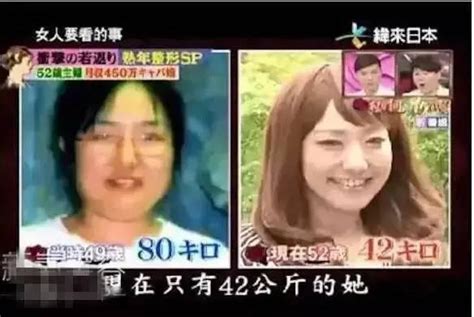 日本大媽花450萬日元整容！從52歲變成25歲少女 ！ 每日頭條