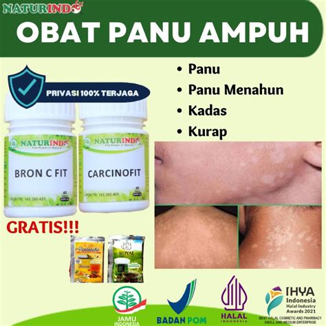 Jual Obat Penghilang Panu Kadas Kurap Menahun Kudis Exsim Panuan