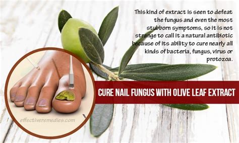 Top 16 Natural Home Remedies For Nail Fungus Removal