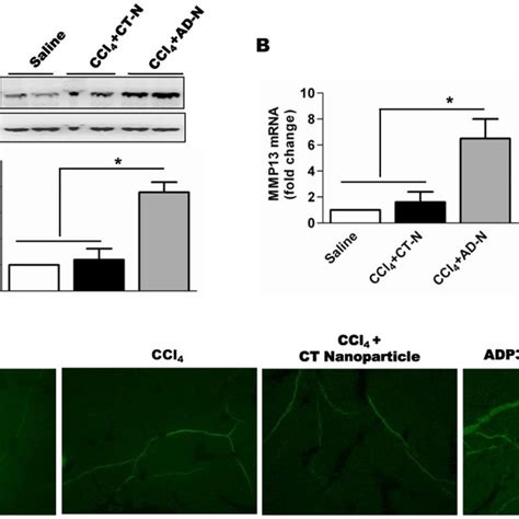 Histological Analysis Of Ccl4 Induced Chronic Liver Injury A