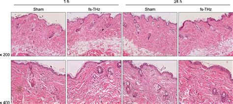 Biological Effects Of Femtosecond Terahertz Pulses On C Bl Mouse Skin