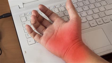 Common Symptoms Of Carpal Tunnel Syndrome My Blog