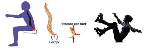 coccydynia – PhysioCraft