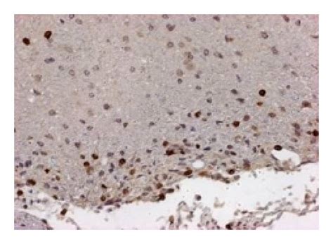 Representative Findings Of The Spinal Cords Stained With Luxol Fast