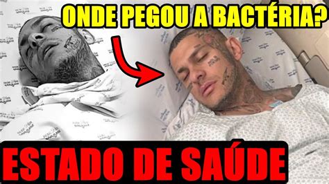 TOGURO PEGA BACTÉRIA E FICA DESACORDADO NO HOSPITAL SAIBA O ATUAL