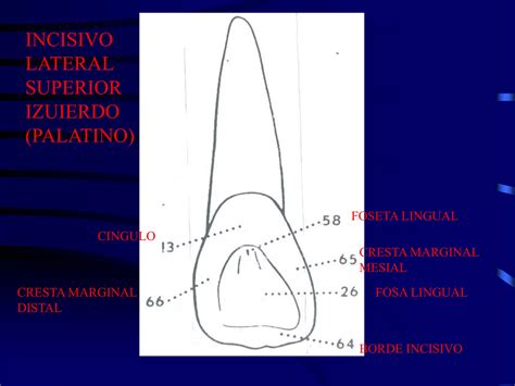 Incisivos Superiores Ppt