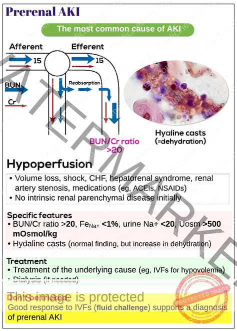 Prerenal acute kidney injury - Medicine Keys for MRCPs