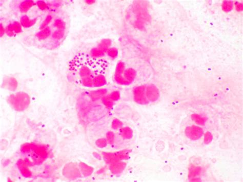 Moraxella Gram Stain