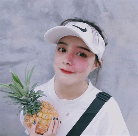 Hot girl với vết chàm lớn trên mặt trở thành mẫu lookbook nổi tiếng Con gái xinh nhất khi tự