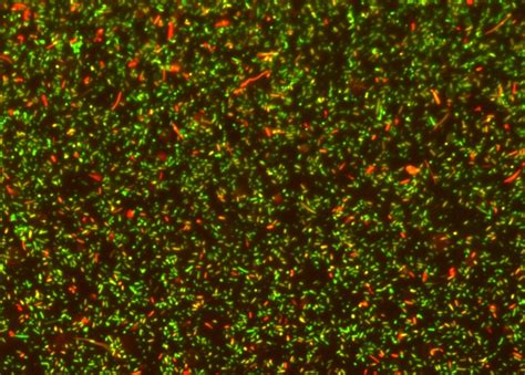 Gram Staining | AAT Bioquest