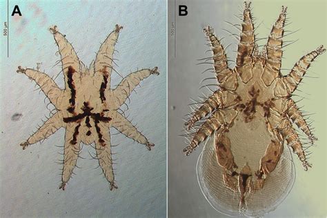 A Deuteroninfa E B Fêmea De Periglischrus Iheringi Espécimes Download Scientific Diagram