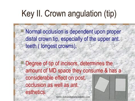 Andrews 6 Keys Of Normal Occlusion Certified Fixed Orthodontic Courses