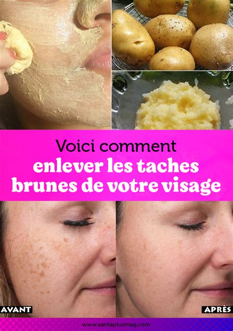 Vous Avez Lhabitude De Faire Des Bains De Soleil Sans Appliquer De