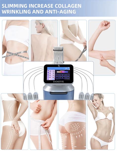 Trusculpt Flex Rf Mhz Bipolar Rf Equipment Skin Tightening Cellulite