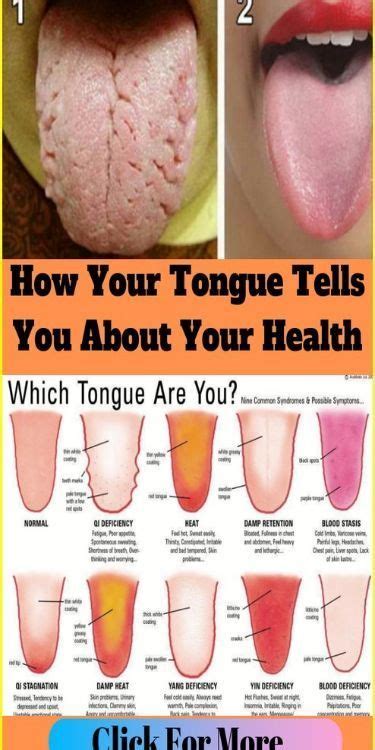 What Does Your Tongue Say About Your Health In Tongue Health