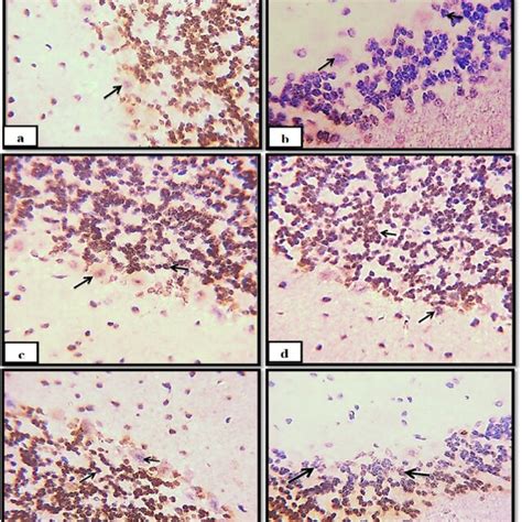 Photomicrograph Of Gfap Immunohistochemical Staining In The Cerebellum