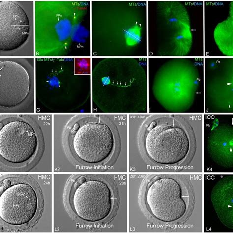 Metaphase Ii Human Oocyte Observed Using Polarized Light Microscopy Download Scientific Diagram