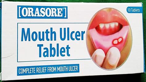 Orasore Mouth Ulcer Tablet Uses Benefits Mouth Ulcer Tablet YouTube