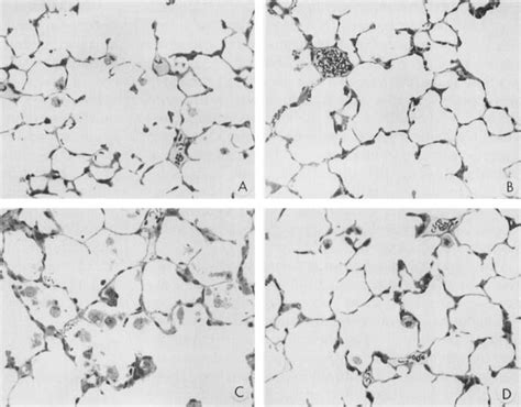 Light Microscopy X Comparison Of The Effects Of Halothane And