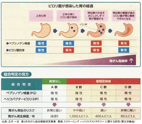 胃がんリスク検診（abc検診）｜町田 相模原の内科・糖尿病内科・胃腸内科・大腸肛門科・小児科なら佐藤寿一クリニックへ