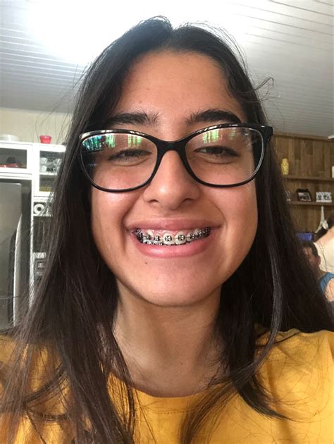 Pin By Pinner On Sorrisos Braces Colors Girls With Glasses Adult Braces