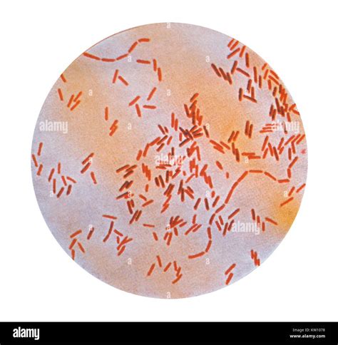 This Illustration Depicts A Photomicrograph Of Salmonella Typhi