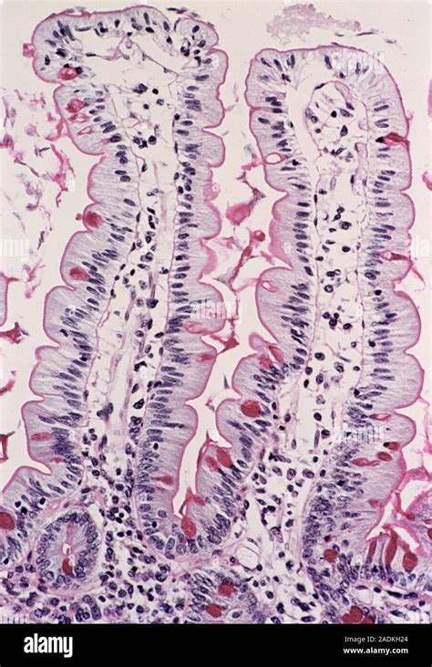 Small Intestine Lining Light Micrograph Of A Section Through The Healthy Lining Of A Human