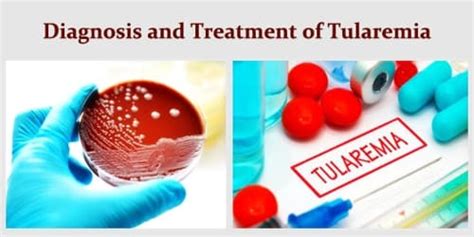 Tularemia Symptoms Diagnosis Treatment And Prevention Assignment