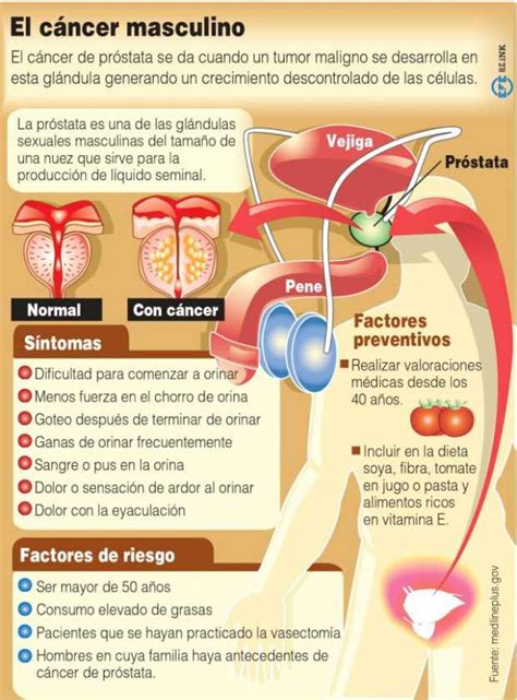 Examen De Próstata Un Regalo Para Su Salud