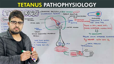 Tetanus Causes Symptoms Prevention And Treatment Biology Lecture