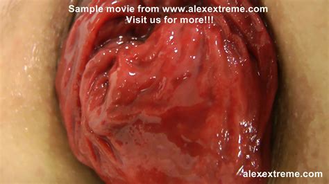 Extreme Anal Fisting Huge Dildos And Prolapse Compilation From