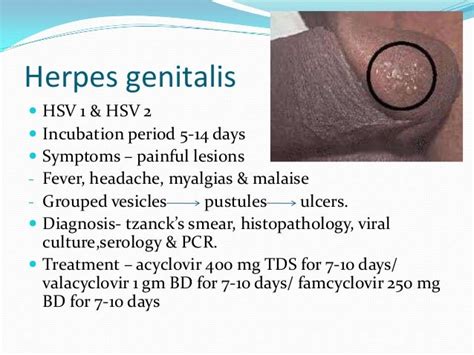 Urethritis