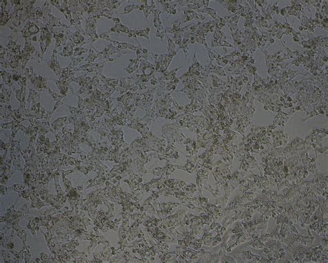 Transfection Protocol Of Adherent Mdck Cells 96 Well Plate Sino