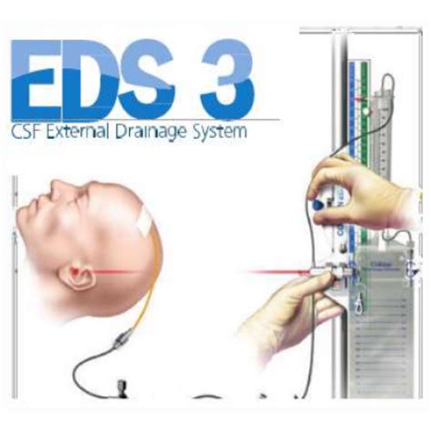 Sistema Dve Drenagem Ventricular Externa Medicicor