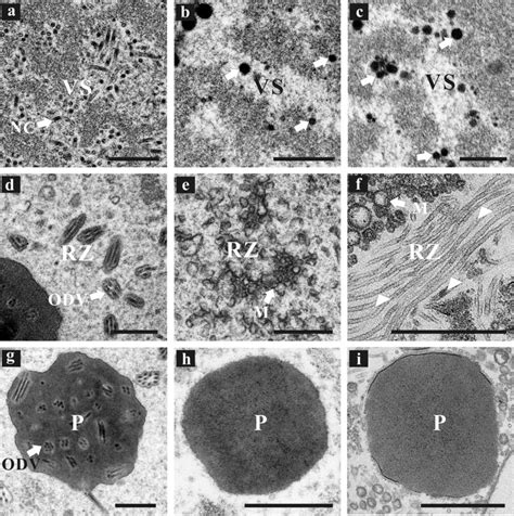 Electron Microscopy Of Sf9 Cells Transfected With Vacvp39 Flag A D