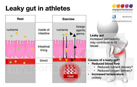 What Causes An Athletes Leaky Gut